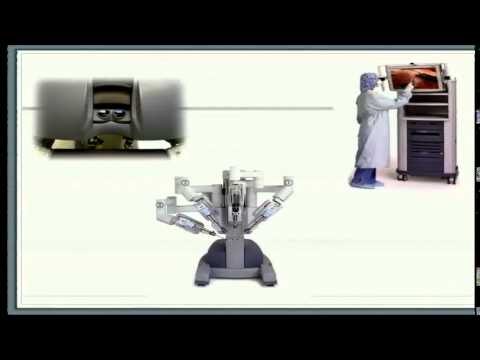Evolución de la Cirugía Robótica