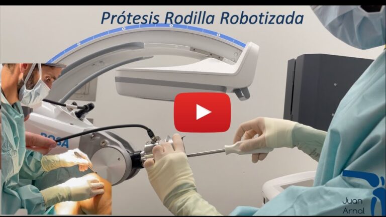 Avances en Pr&oacute;tesis de Rodilla Rob&oacute;tica: Innovaciones y Beneficios