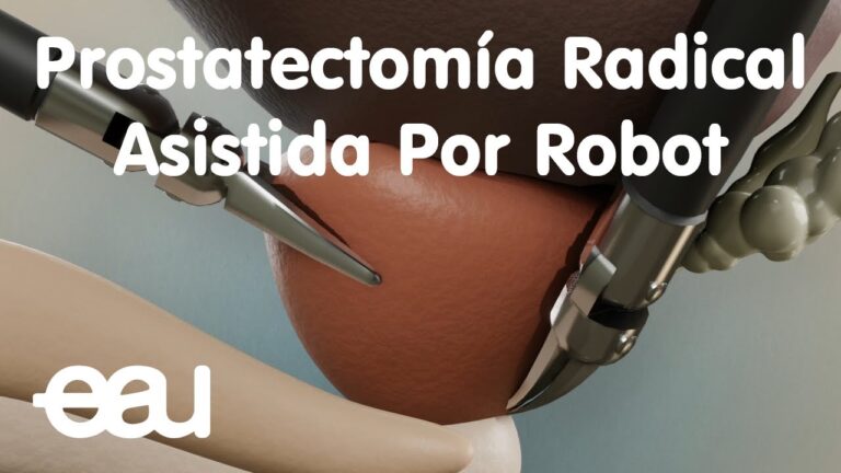 Avances en Cirugía Prostática Robótica